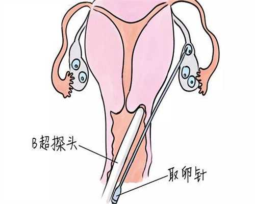 国内代怀哪家靠谱_国内有找代怀的吗,三代试管婴儿需要花费多少钱