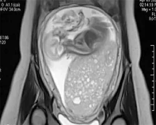 代孕怎么提取精子和卵子-代孕是怎么付款的,宜兴月子中心排名早了解！怎么样