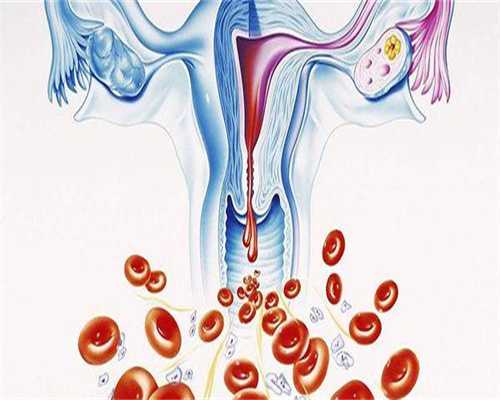 三代试管婴儿如何计算末次月经，5000够吗？