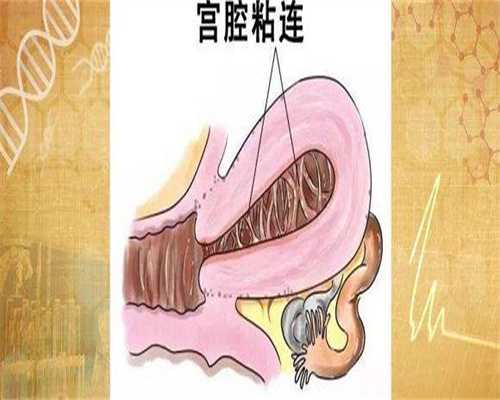 供卵代生网:卵巢早衰能做辅助生殖吗