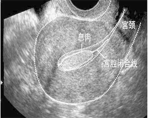 兰州试管助孕网
